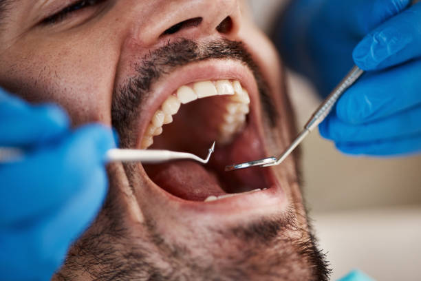 Best Weekend Emergency Dental Services in Wellston, OH